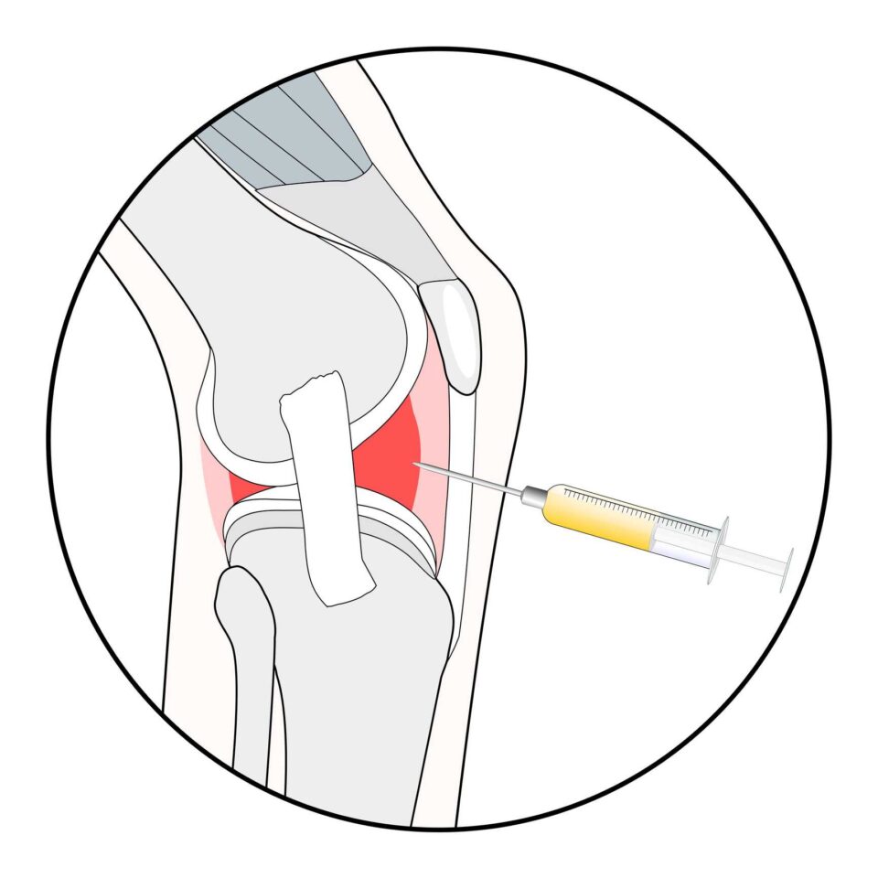 biologic treatments