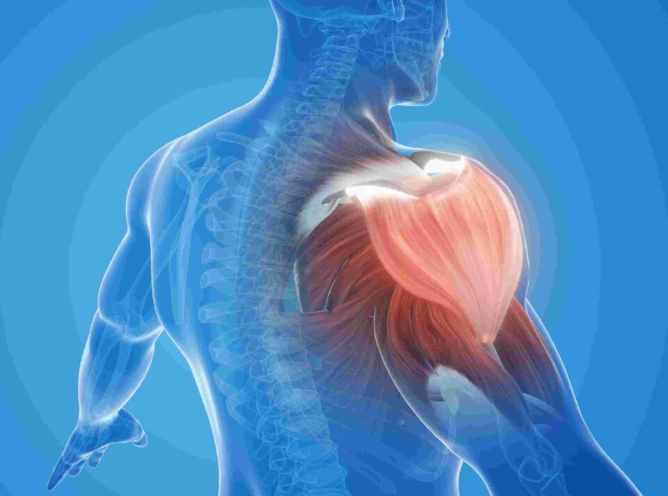 shoulder pain relief